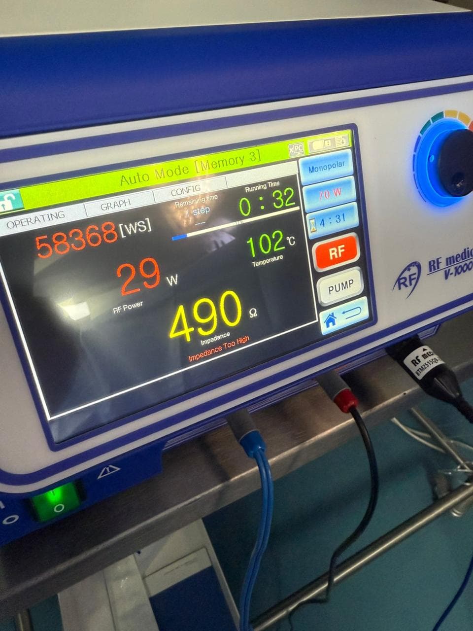 Generador de radiofrecuencia utilizado durante procedimiento MYOBLATE